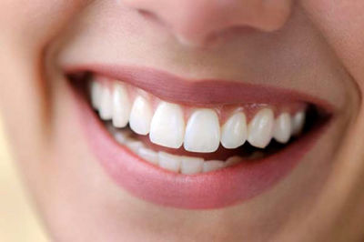 دندان سفید را با این روش تجربه کنید
